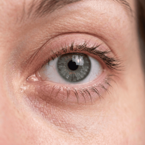 Red Eye